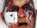 Британские грабители жестоко избили 89-летнего ветерана Второй мировой войны и его жену