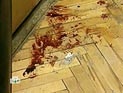 Жительницу Белоруссии, отрезавшую мужу гениталии, отправят на лечение