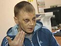 Под Новосибирском наркоманы избили главу антинаркотического фонда и его коллег Под Новосибирском наркоманы избили главу антинаркотического фонда и его коллег