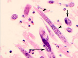    ,      ,     -  ,    Halicephalobus gingivalis